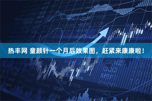 热丰网 童颜针一个月后效果图，赶紧来康康啦！